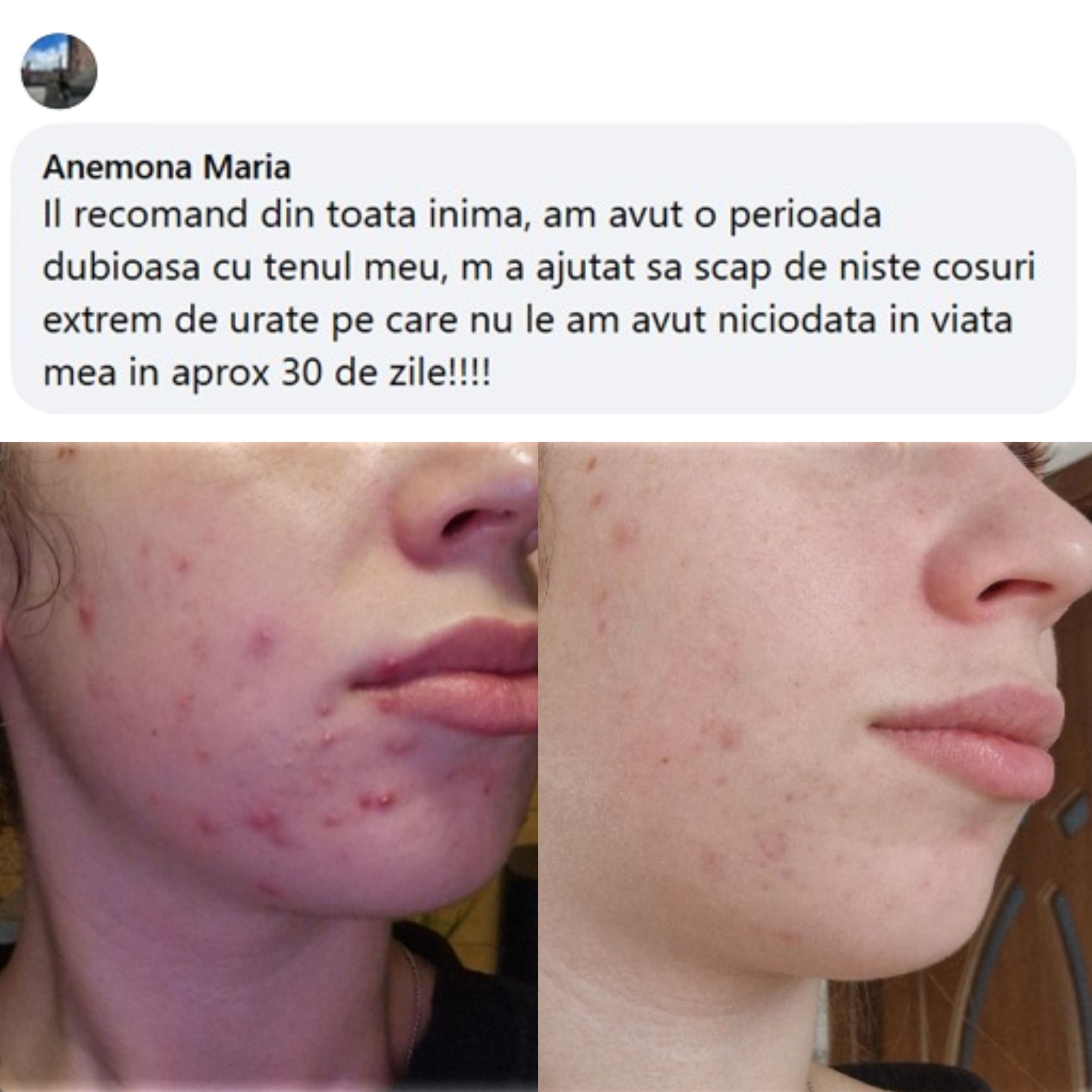 Recenzie Anemona